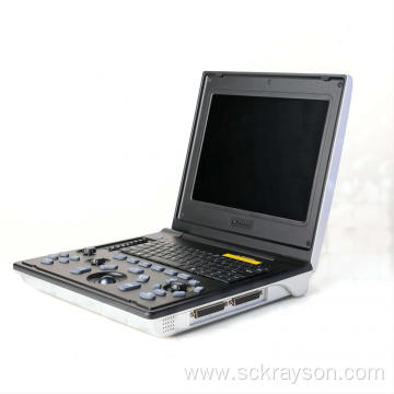 Gold gradient gallbladder ultrasound diagnostic equipment